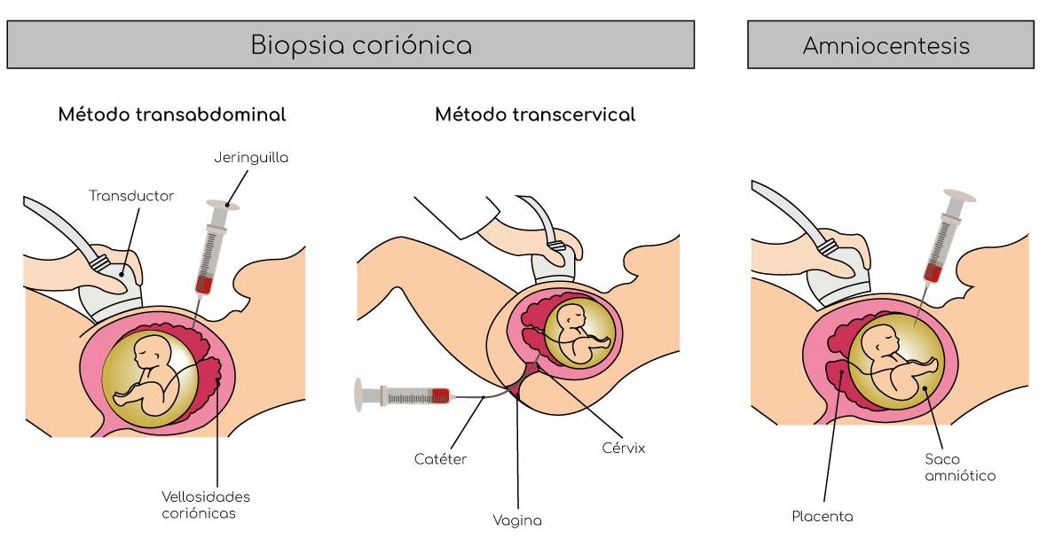 Secuencia de POTTER: Tipos y CAUSAS Reveladas en Terapia 12 secuencia de potter tipos y causas reveladas en terapia