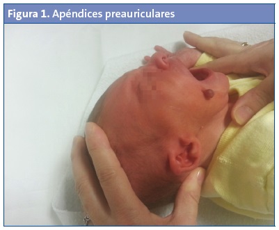 Síndrome de Goldenhar: Síntomas y Soluciones en Madrid 2 sindrome de goldenhar sintomas y soluciones en madrid