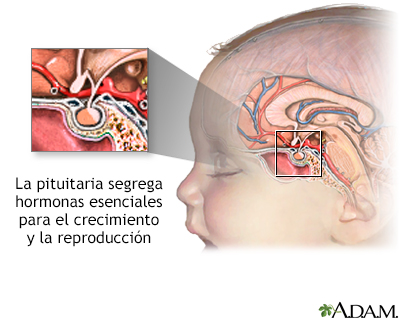 Síndrome de la SILLA TURCA VACÍA - Qué es y CÓMO afecta 2 sindrome de la silla turca vacia que es y como afecta