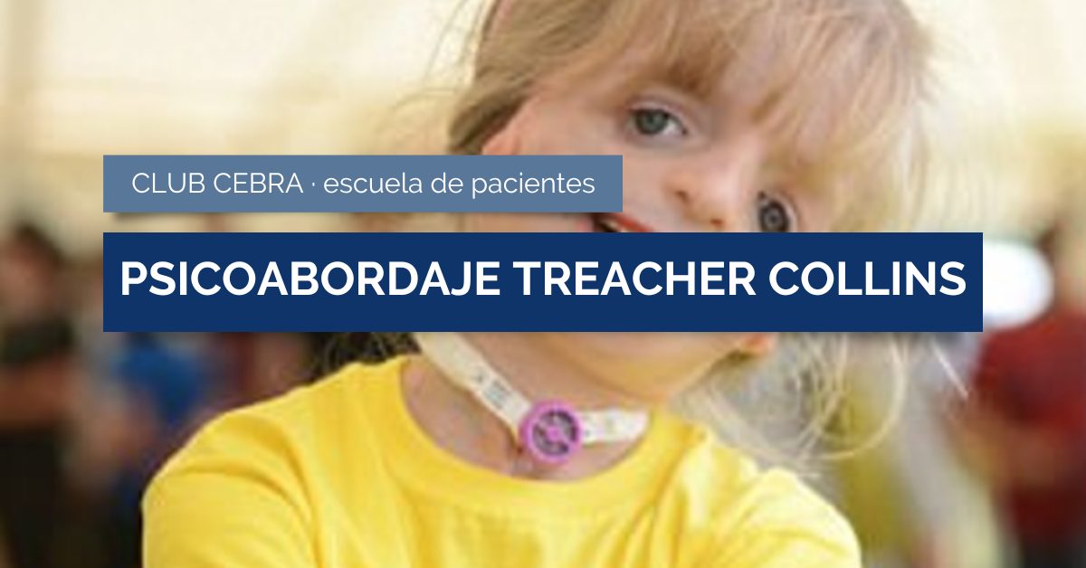 Síndrome de Treacher Collins: Descubre Síntomas y Soluciones 2 sindrome de treacher collins descubre sintomas y soluciones