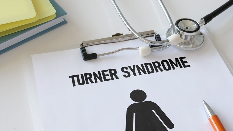 Síndrome de TURNER: Síntomas, TIPOS y Tratamiento ESENCIAL 2 sindrome de turner sintomas tipos y tratamiento esencial