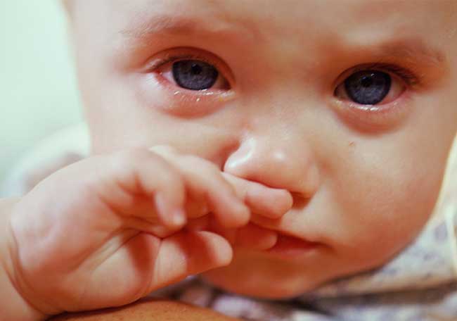 SÍNDROME DEL BEBÉ SACUDIDO: Diagnóstico y Tratamiento CLAROS 6 sindrome del bebe sacudido diagnostico y tratamiento claros