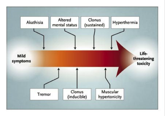 sindrome serotoninergico causas y tratamientos esenciales