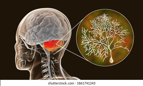 Sistema de PURKINJE: CÉLULAS CLAVE en el CEREBELO y CORAZÓN 8 sistema de purkinje celulas clave en el cerebelo y corazon