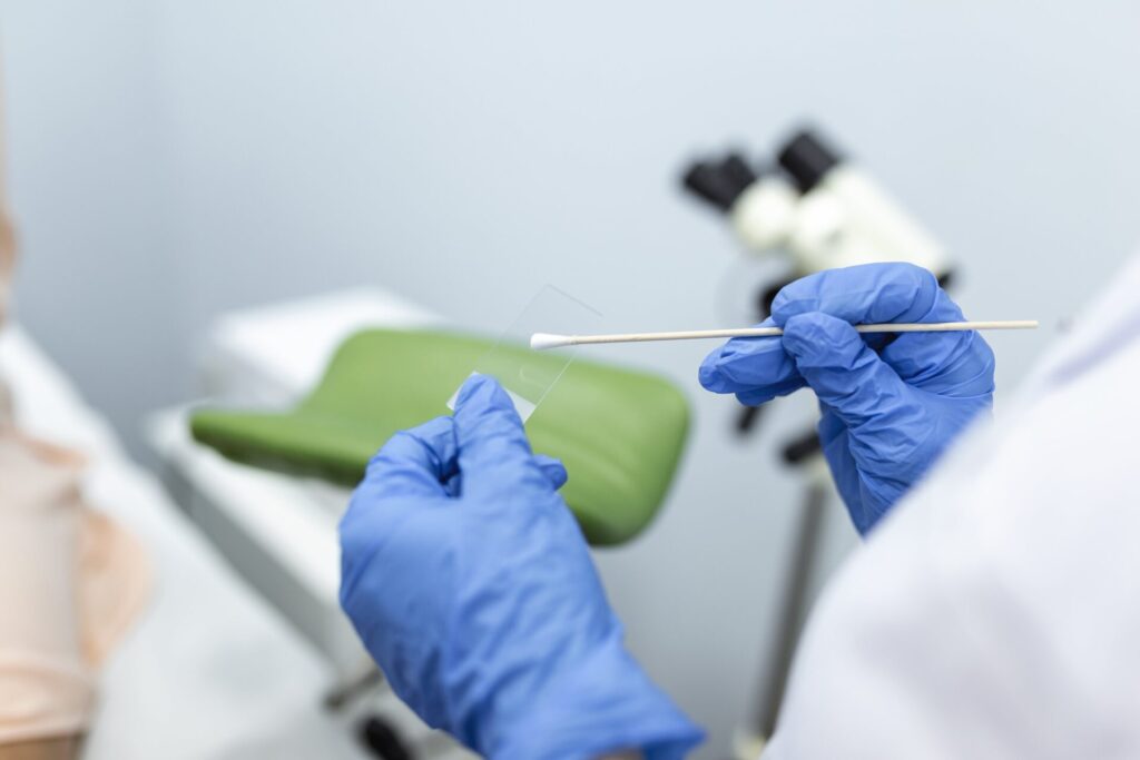 SMEAR: Descubre su Significado, Causas y Tratamiento 2 smear descubre su significado causas y tratamiento