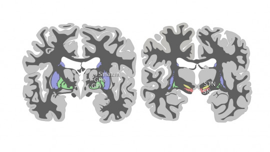 sustancia negra en el cerebro funciones y trastornos clave