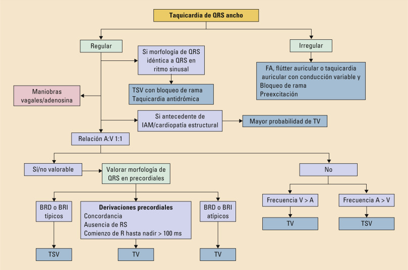 taquicardia sinusal: Es PELIGROSA TIPOS y CAUSAS Explicadas 2 taquicardia sinusal es peligrosa tipos y causas