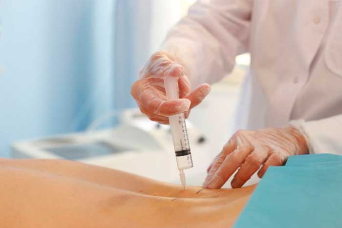 Terapia de OZONO: Mejora tu SALUD de manera INNOVADORA 2 terapia de ozono mejora tu salud de manera innovadora