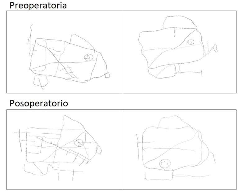 Test FIGURA COMPLEJA de REY: Qué MIDE 7 RAZONES ÚTILES 2 test figura compleja de rey que mide 7 razones utiles