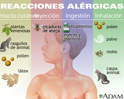 Tipos de ALERGIAS: DESCUBRE sus CARACTERÍSTICAS y SÍNTOMAS 2 tipos de alergias descubre sus caracteristicas y sintomas