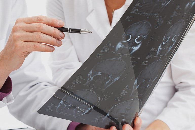 Tipos de NEURÓLOGOS: Especialidades y PATOLOGÍAS en MADRID 2 tipos de neurologos especialidades y patologias en madrid