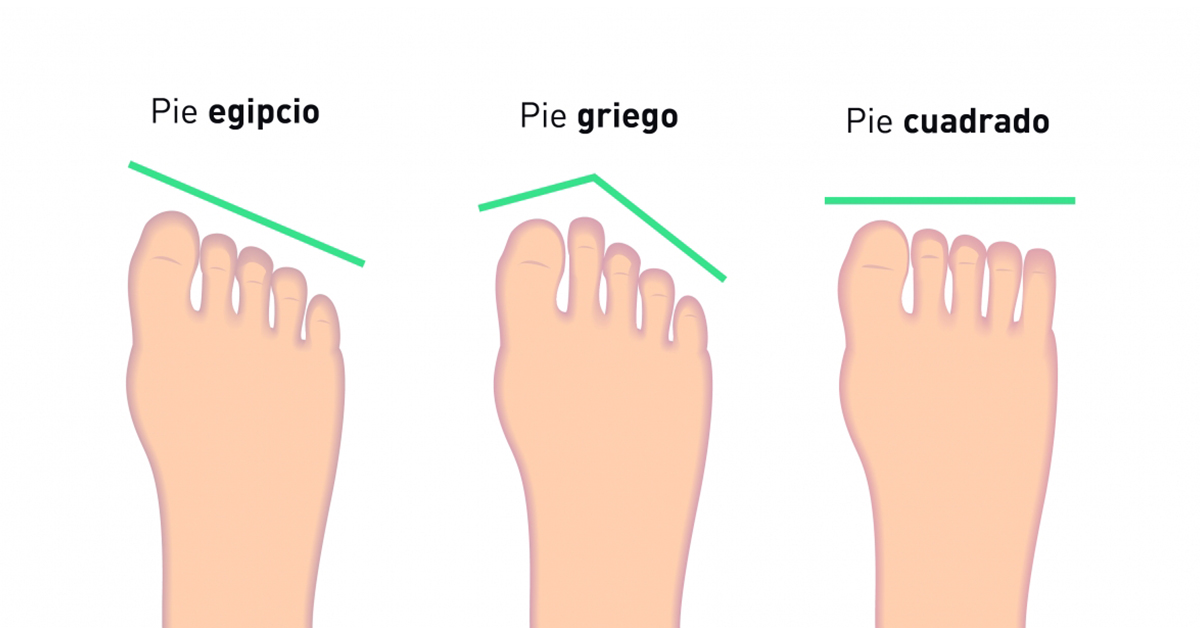 Tipos de PIE: Descubre tus PATOLOGÍAS y CUIDADOS Esenciales 2 tipos de pie descubre tus patologias y cuidados esenciales