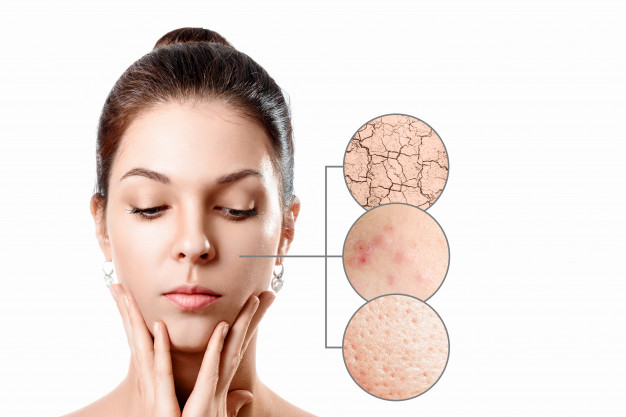 Tipos de PIEL: Descubre los 4 TIPOS y su CUIDADO ESENCIAL 2 tipos de piel descubre los 4 tipos y su cuidado esencial