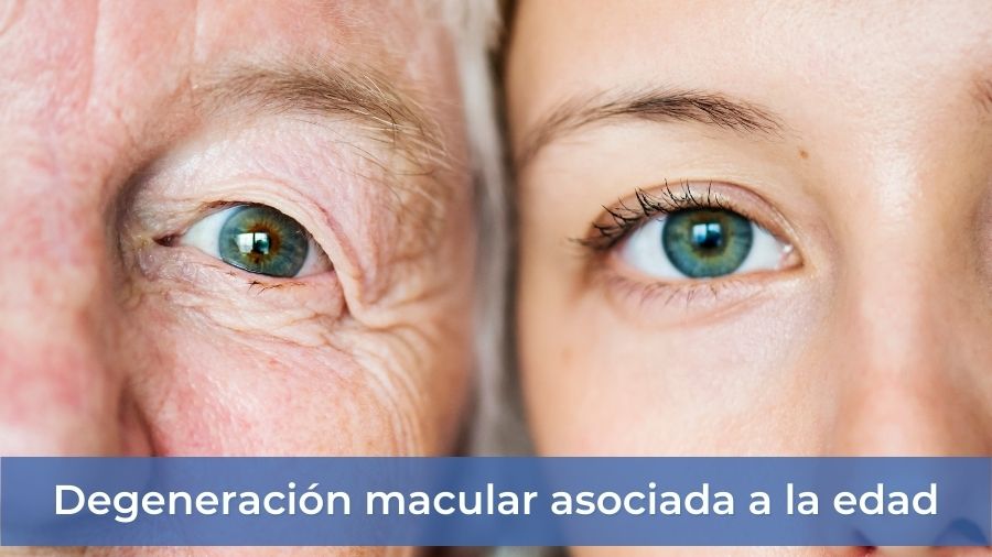 todo sobre la degeneracion macular sintomas y soluciones